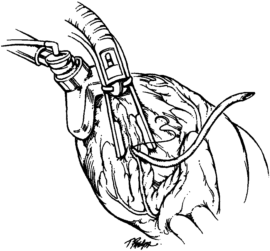 手術(shù)技術(shù)